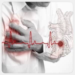 Причины возникновения инфаркта