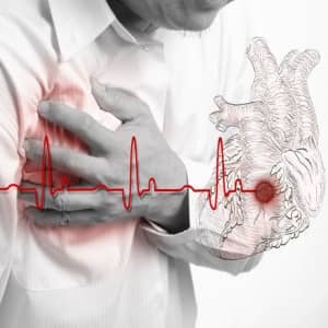 Причины возникновения инфаркта миокарда, симптомы и народное лечение