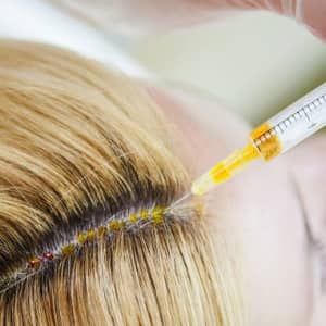 Аппаратные методы при выпадении волос
