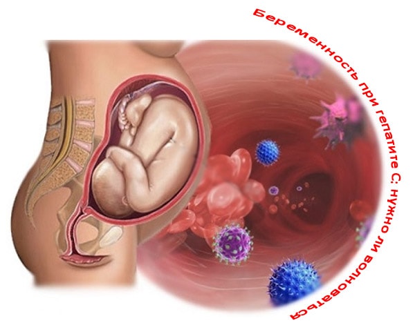 Беременность при гепатите С: нужно ли волноваться