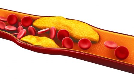 Холестерин: разрушение пяти мифов об этом веществе в крови